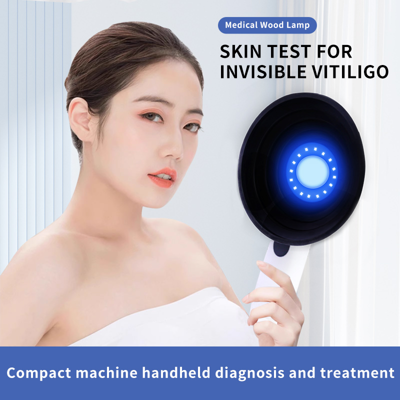 Medical Woods Lamp Skin Examination Skin Fungus Detector Vitiligo Pityriasis Versicolor Melasma Detector Woods Light