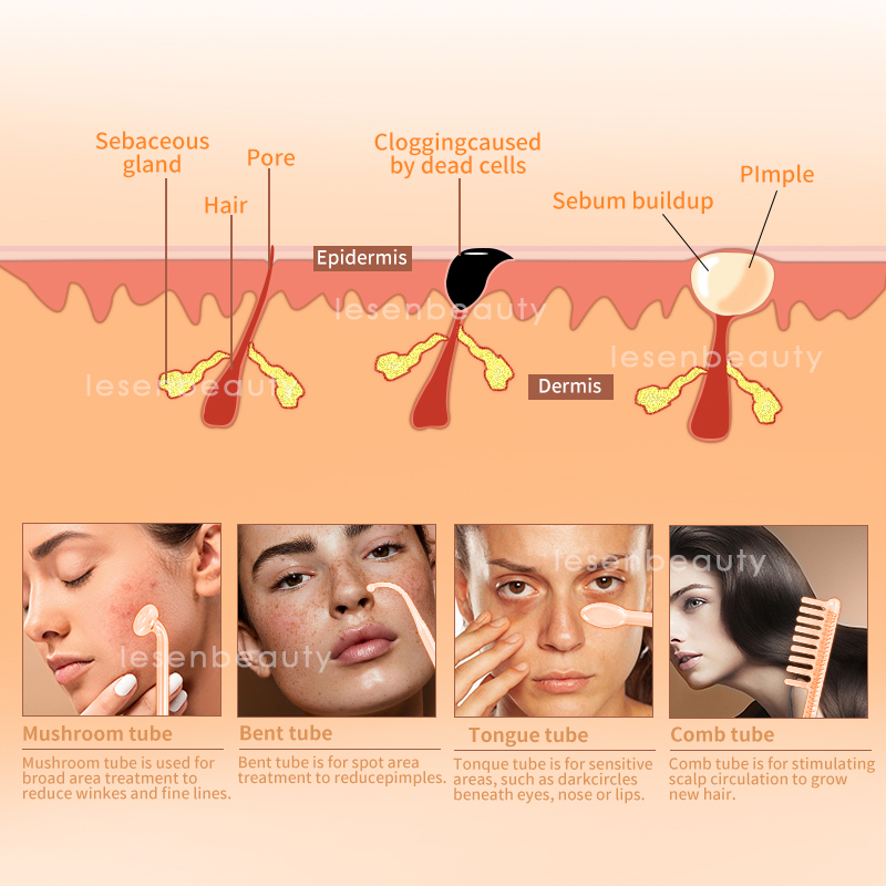 High Frequency Electrode Vibration Wand Machine Handheld Skin Tightening Acne Spot Wrinkles Remover Beauty Therapy Puffy Eyes