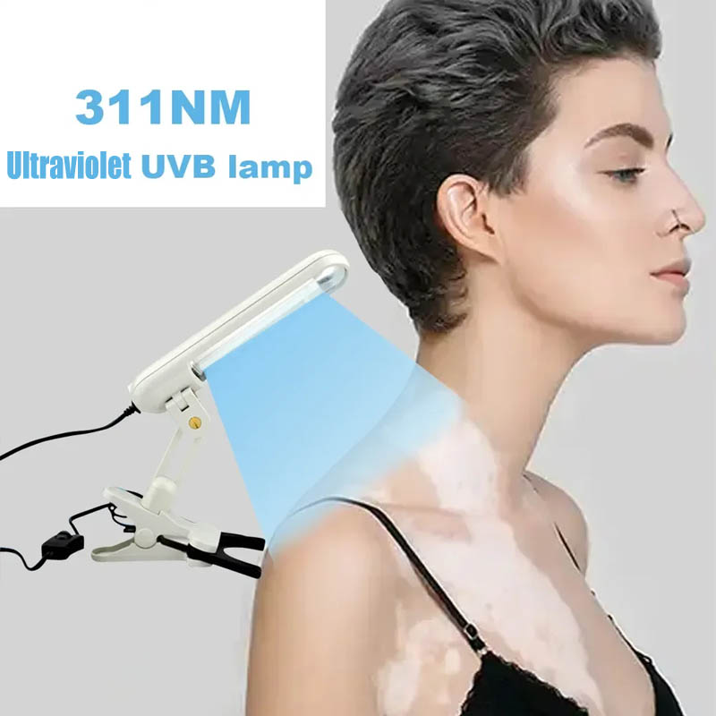 Uvb Phototherapy Narrow 311nm Uv Phototherapy Lamp Uvb Light Therapy Psoriasis For Vitiligo