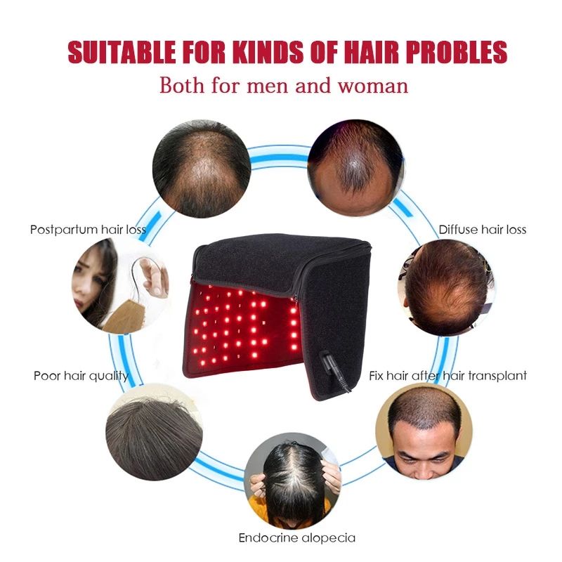 215 Beads for Hair Loss Promote Hair Fast Regrow Care Cap LED Red Light Therapy Hat For Hair Growth Red & Infrared Light Hair Gr