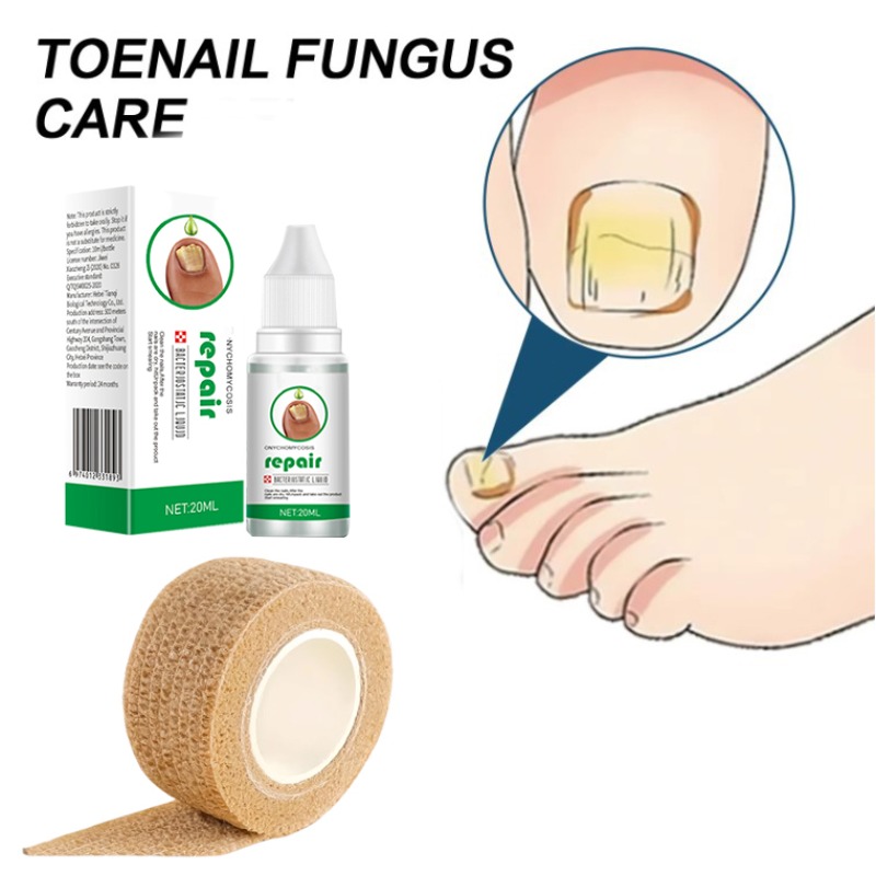Toe protection, self-adhesive bandage, fungal nail polish, foot and finger protection, nail coating, toe and finger protection