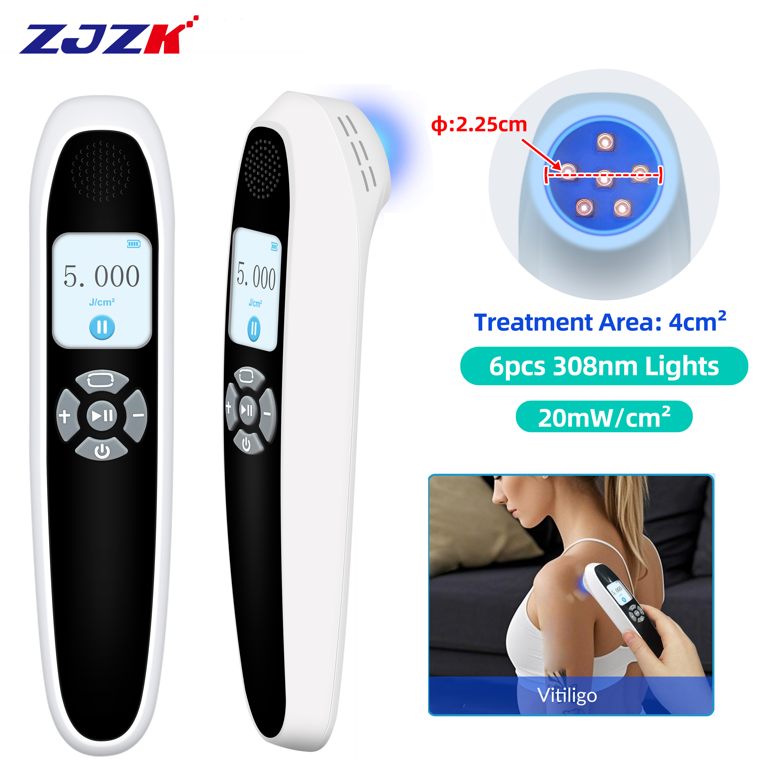 308nm UVB Light Therapy for Skin Conditions Vitiligo Psoriasis Eczema Narrowband Ultraviolet B Phototherapy Lamp 6pcs 20mW