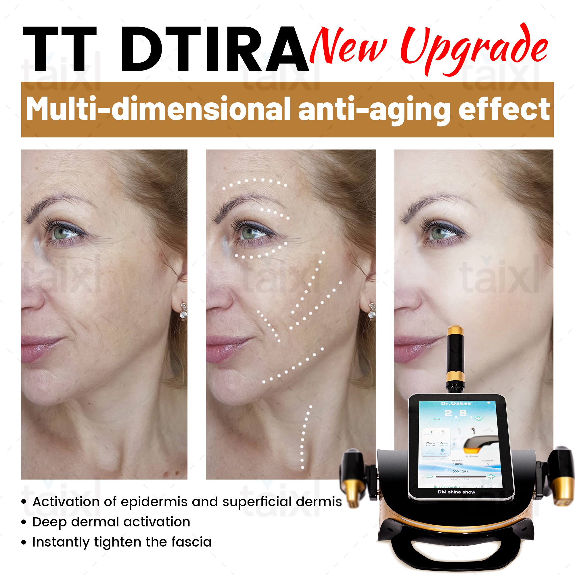 2025 Professional Portable TT Double Lift Facial Lift Body Lift Skin Firming Anti Aging Skin Sejuvenation Firming Machine.