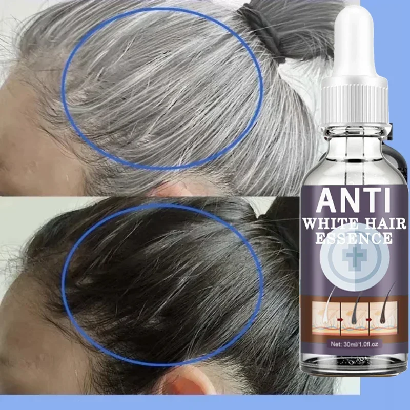 White hair killer, remove gray hair and restore natural hair color in 7 days