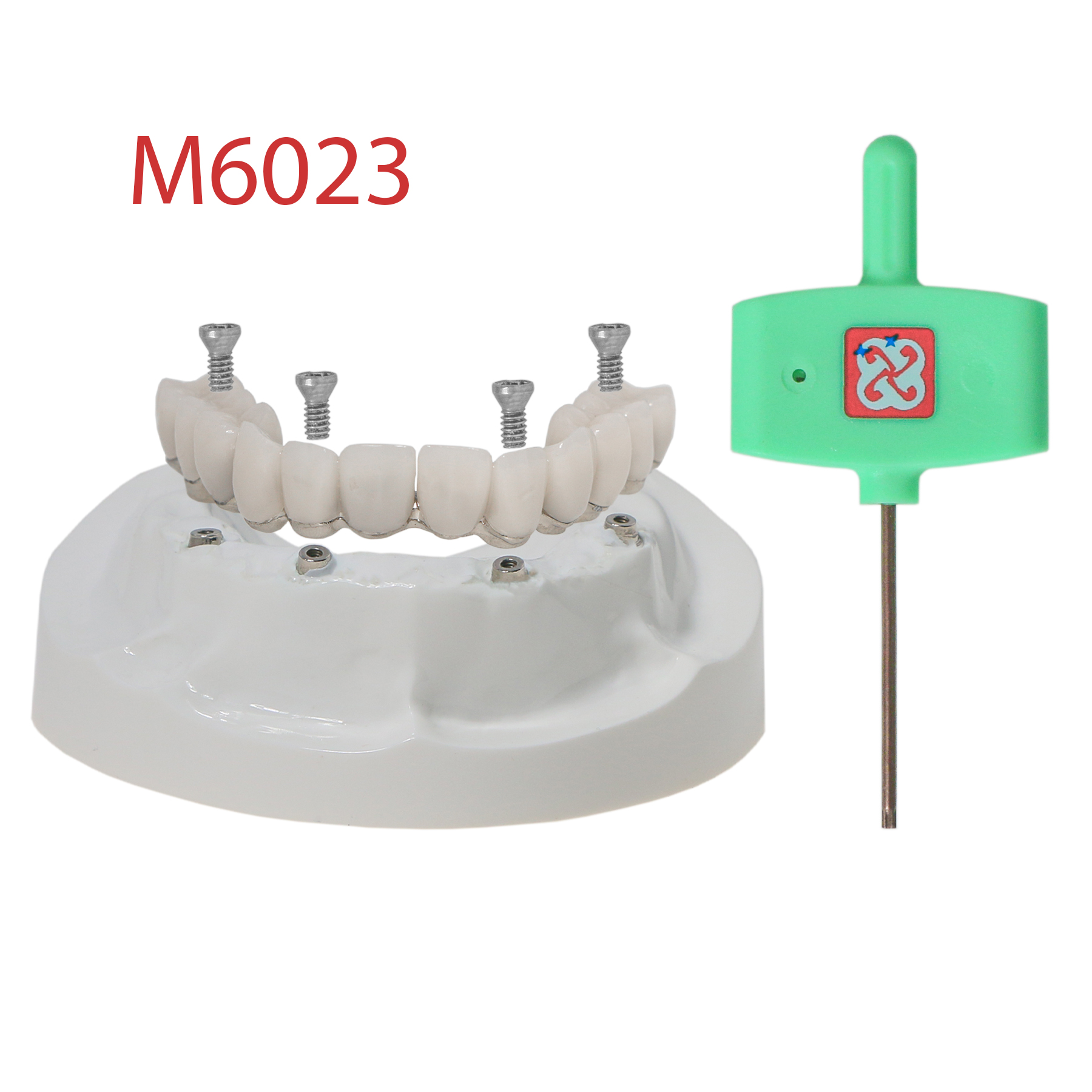 Dental Implant All-on-4 Overdenture Model Upper Jaw Restoration With 4 Screws M6023