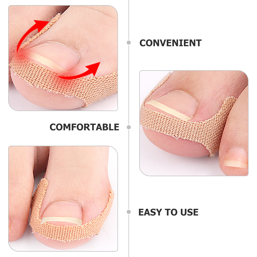 100pcs Correction Patch Toenail Patches Elasticity Fabric Ingrown Corrector Strips Self Application Foot Care Tool Nail