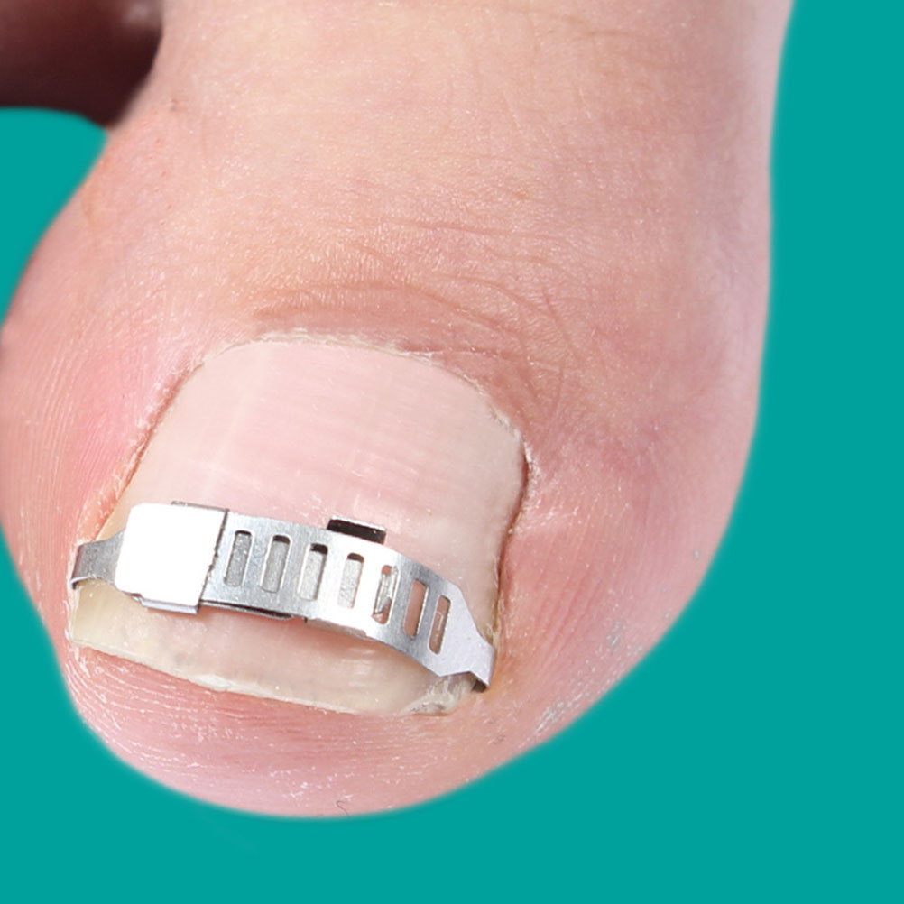 Stainless Steel Ingrown Toenail Tool Pedicure Corrector Set Nail Buckle Brace For Healthy Nails Prevent Growing Into Flesh Care