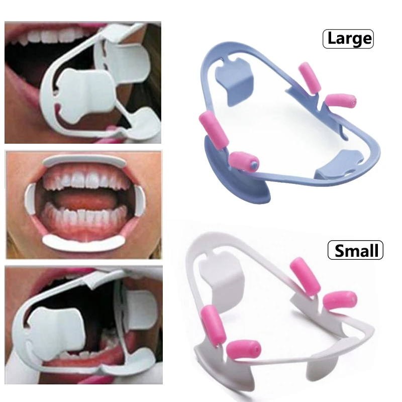 3D Oral Dental Mouth Opener Intraoral Cheek Lip Retractor Prop Oral Orthodontic Instrument Dentist Tools