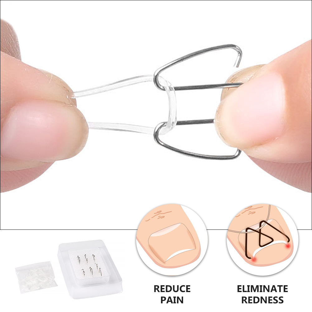 Ingrown Nail Corrector Toe thosis Manicure Tool Paronychia Care Premium Durable Lightweight Travel Outdoor Nail Correction Tool