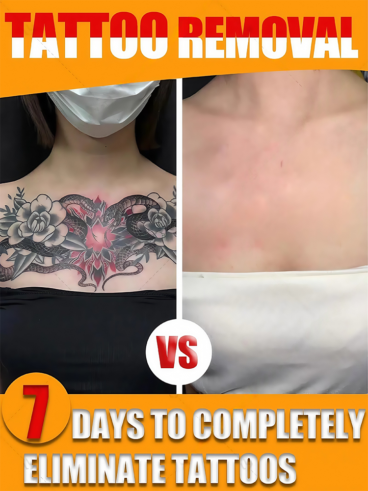 ᶠᵃˢᵗ ᵀᵃᵗᵗᵒᵒ ᴿᵉᵐᵒᵛᵉʳ ᴾⁱᵍᵐᵉⁿᵗᵉᵈ ᴾᵉʳᵐᵃⁿᵉⁿᵗ ᴹᵃᵏᵉᵘᵖ ᵀᵃᵗᵗᵒᵒ ᴿᵉᵐᵒᵛᵃˡ