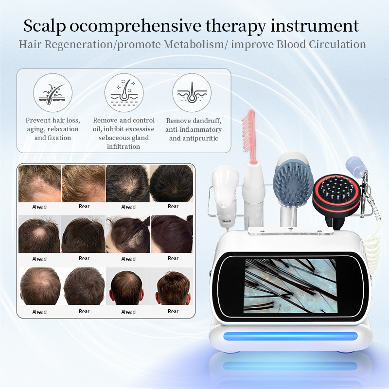 Five-in-one scalp care machine ozone mite removal scalp cleaning hair root care anti-hair loss hair regeneration