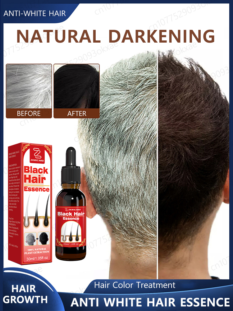 ᵀʰᵉ ᵖˡᵃⁿᵗ ᵇˡᵃᶜᵏ ʰᵃⁱʳ ᵉˢˢᵉⁿᶜᵉ ᵗʰᵃᵗ ⁱˢ ᵇᵉⁱⁿᵍ ᵖᵘʳᶜʰᵃˢᵉᵈ ᵃˡˡ ᵒᵛᵉʳ ᵗʰᵉ ᴵⁿᵗᵉʳⁿᵉᵗ