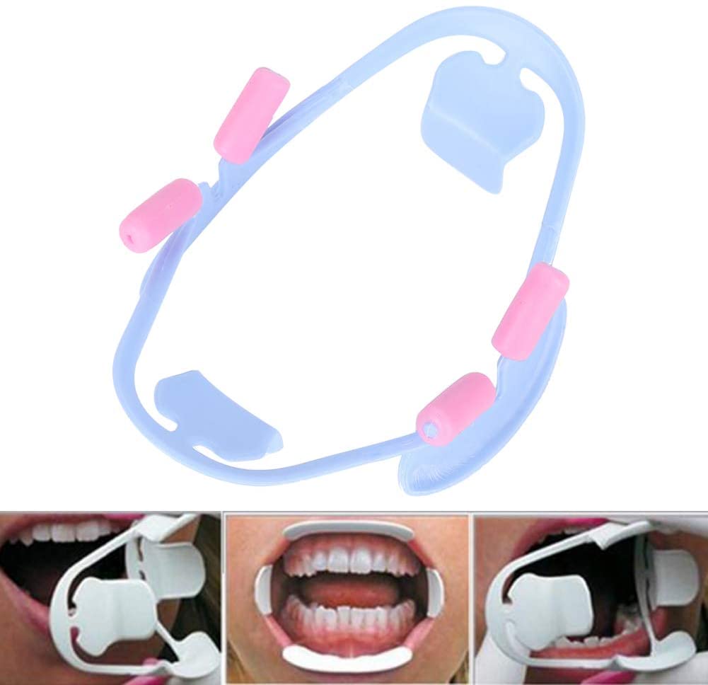 3D Oral Dental Mouth Opener Dental Instrument Lip Retractor Orthodontic Professional Dentist Tools Dentistry Materials