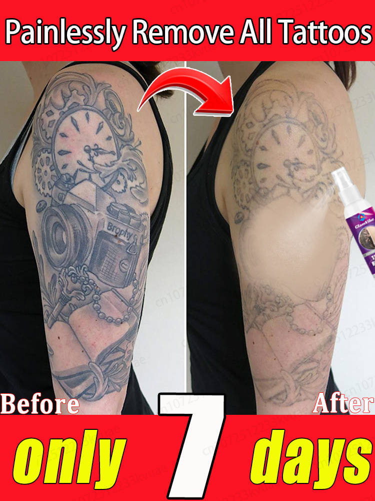 Natural ingredient fading spray, gently decomposes pigment without damaging the skin, painless and leaving no marks