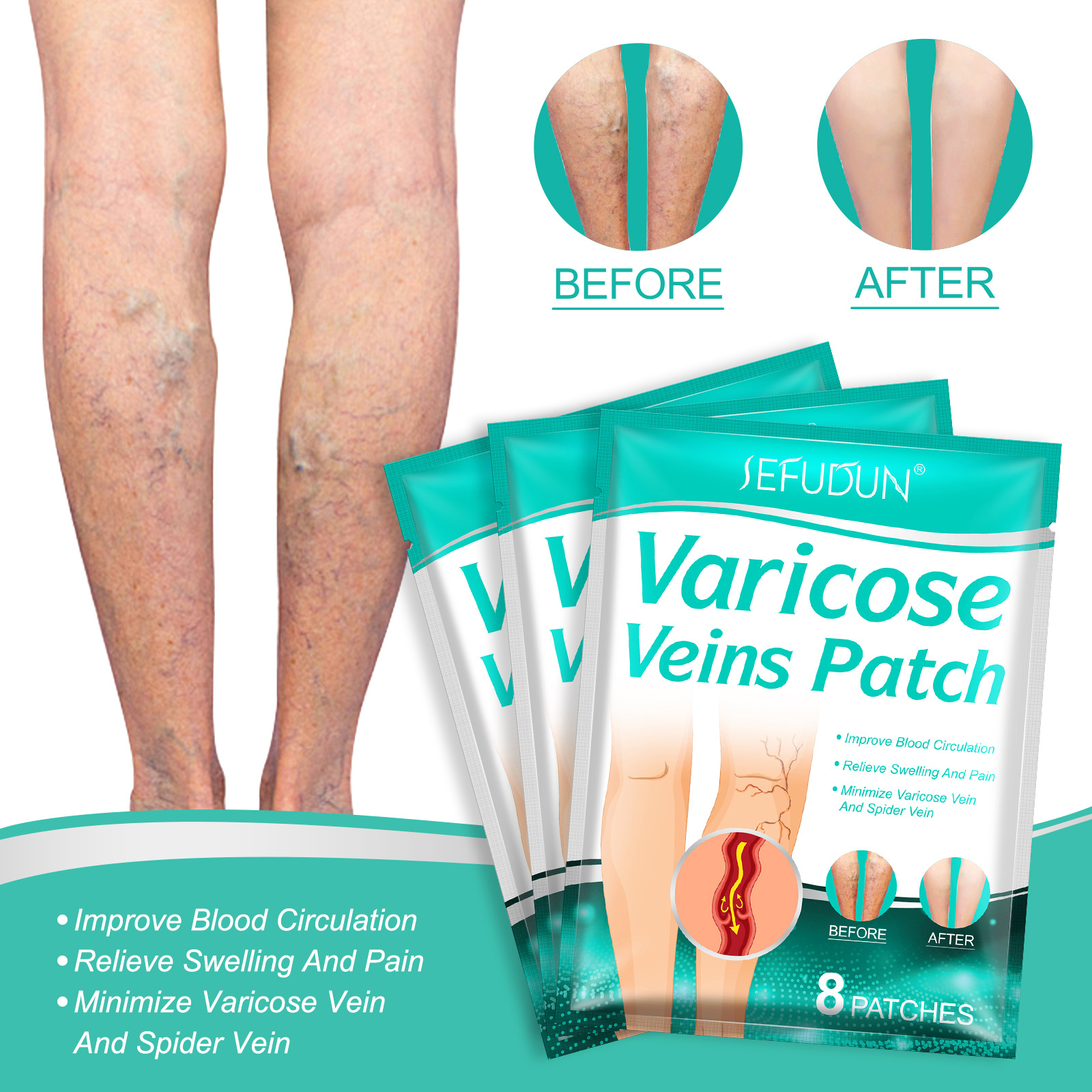 8pcs Varicose Veins Treatment Patch Legs Sore Swelling Plaster Promote Metabolism Promote Smooth Blood Circulation Care Patch