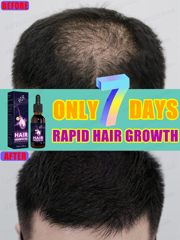 ⁱᵗ ᵒⁿˡʸ ᵗᵃᵏᵉˢ ⁷ ᵈᵃʸˢ ᵗᵒ ᵗᵘʳⁿ ᵇᵃˡᵈⁿᵉˢˢ ⁱⁿᵗᵒ ᵗʰⁱᶜᵏ ʰᵃⁱⁿ