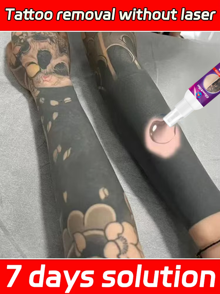 Tattoo Removal Spray Pigmented Permanent Makeup Tattoo Removal