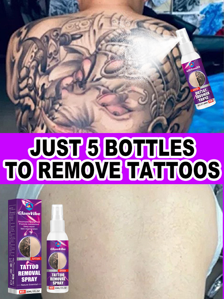Tattoo removal spray, suitable for large and small tattoos, effectively removes permanent tattoos