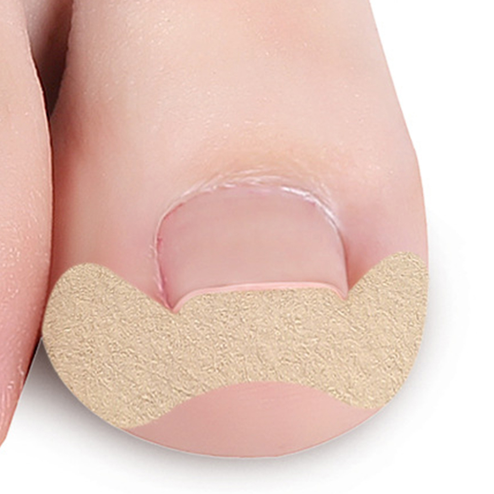 10pcs Ingrown Toenail Corrector Self Adhesive Toe Protectors Non Woven Fabric Gel Curved Nail Stickers Longlasting Solution For