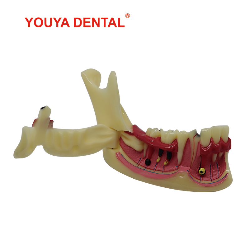 Dental Endodontic Treatment Model Right Side Mandible Tissue Anatomical Model Anatomy Of Gums Teeth Models For Studying Teaching
