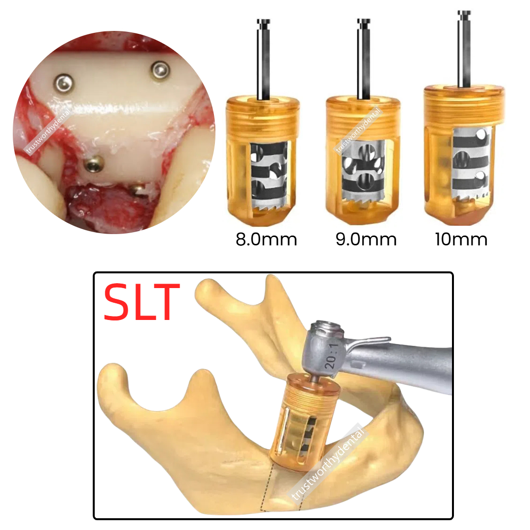 Dental Easy Bone Collector Semilunar Technique GBR SLT Drill Implant Semilunar Shell Bone Argumentation Harvest Half moon EBC