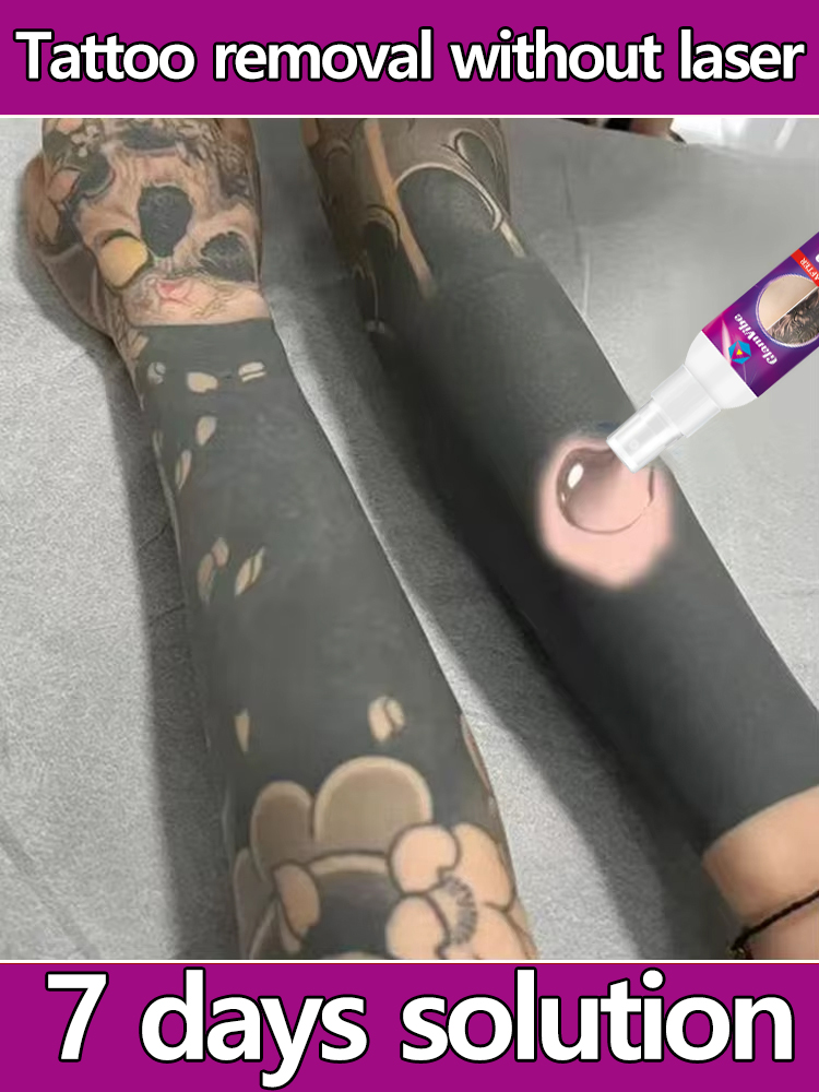 Tattoo Removal Spray Pigmented Permanent Makeup Tattoo Removal