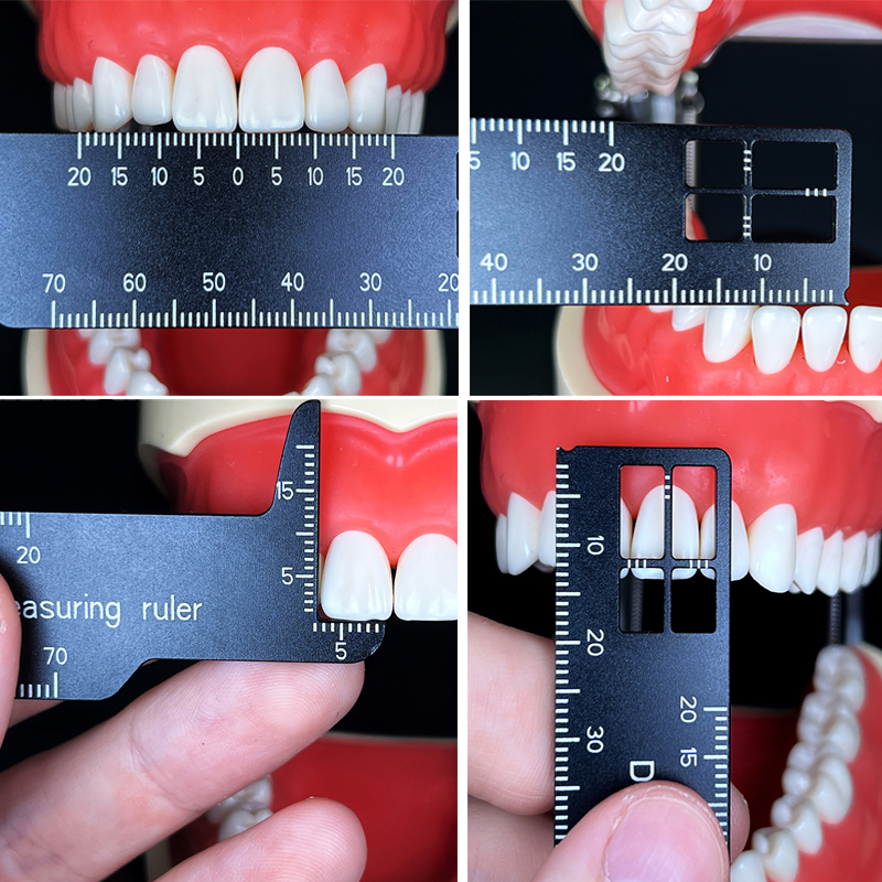 Autoclavable Dental Precision Teeth Measuring Ruler For Dentistry Photography And Tooth Measurement Tools