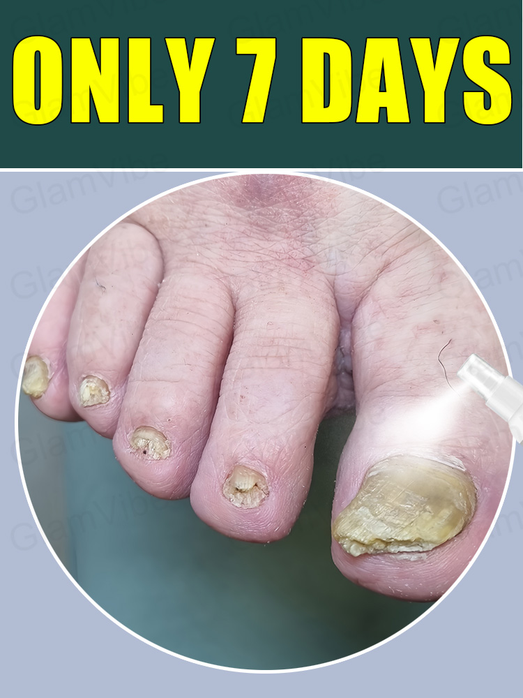 5G8hJ3kL6mN9oP2qR5sT6uV8wX1yZ4A7b9C3dF2g5h6I8jK1l4M7nO9pQ2rR5sT6uV8wX1yZ4A7b9C3dF2g5h6I8jK1l4M7nO9pQ