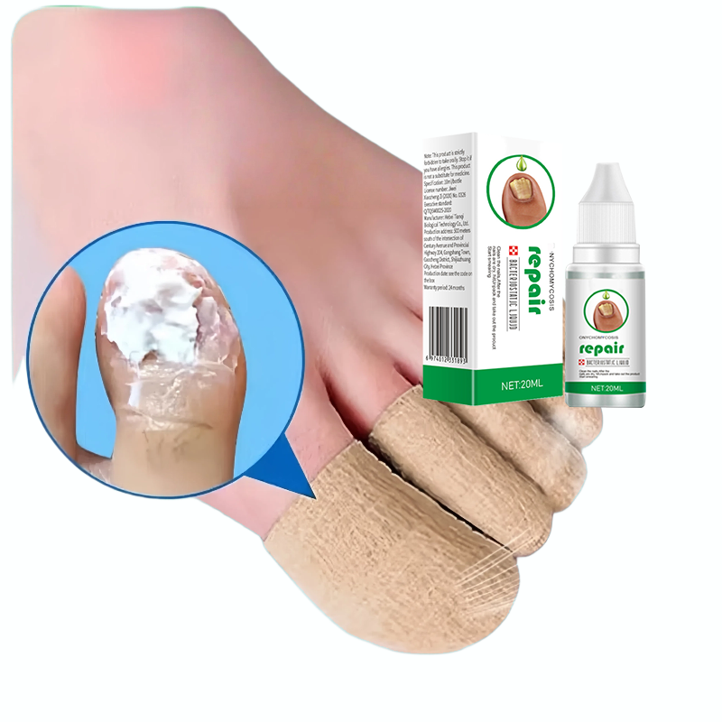 Toe protection, self-adhesive bandage, fungal nail polish, foot and finger protection, nail coating, toe and finger protection